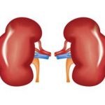 Malattia renale cronica in aumento ne soffrono in oltre 800 milioni