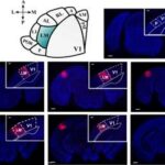 Le aree visive superiori del cervello influiscono sulla percezione della realta