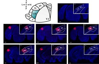 Le aree visive superiori del cervello influiscono sulla percezione della realta