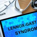 Lo studio piu di 1 anno per una diagnosi di sindrome di Lennox Gastaut