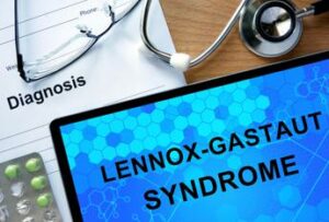 Lo studio piu di 1 anno per una diagnosi di sindrome di Lennox Gastaut